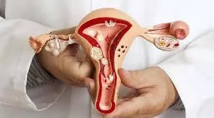 خياطة غشاء البكارة | Hymenoplasty illustrative image