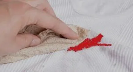 ترميم الغشاء بالجراحة | Hymenoplasty illustrative image